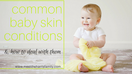 Your Baby is So Proud of You for Learning About Common Baby Skin Conditions and How to Care for Them